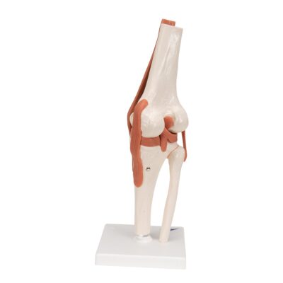 A82_03_1200_1200_Functional-Human-Knee-Joint-Model-with-Ligaments-3B-Smart-Anatomy-400×400-1.jpg
